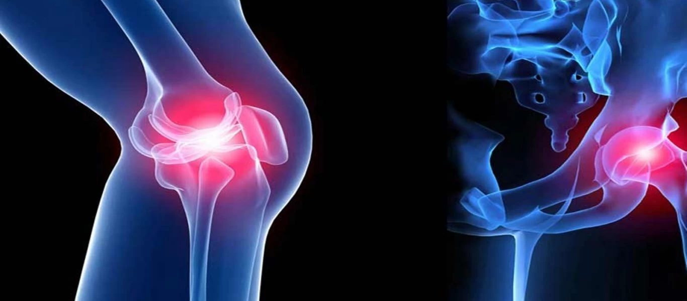 Έχετε πόνο στις αρθρώσεις; - Αυτές είναι οι 7+1 «απαγορευμένες» τροφές